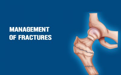 Management of Fractures