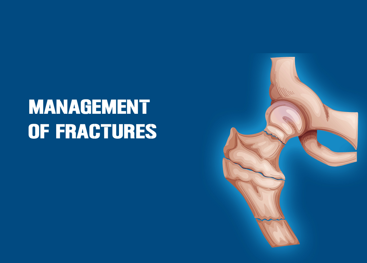 Management of Fractures