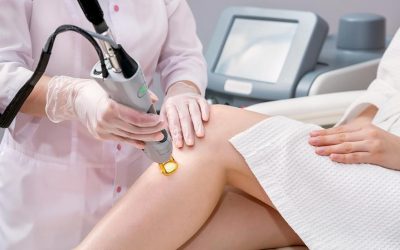 Know More About Laser Hair Removal