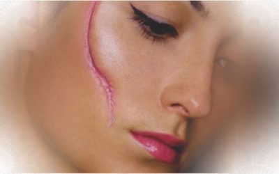 Why Scars??