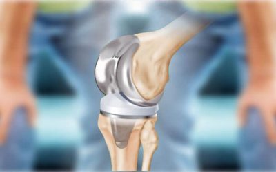 Joint Replacement Surgery A Successful Treatment