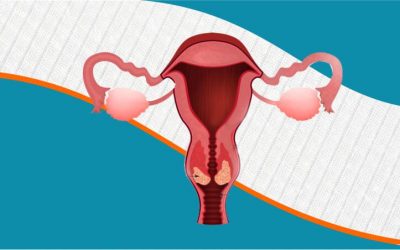 What Is Cervical Cancer?