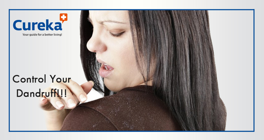 Control Your Dandruff