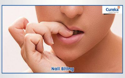 Nail Biting