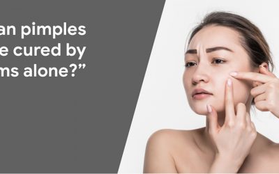 Can Pimples Be Cured By Creams Alone?