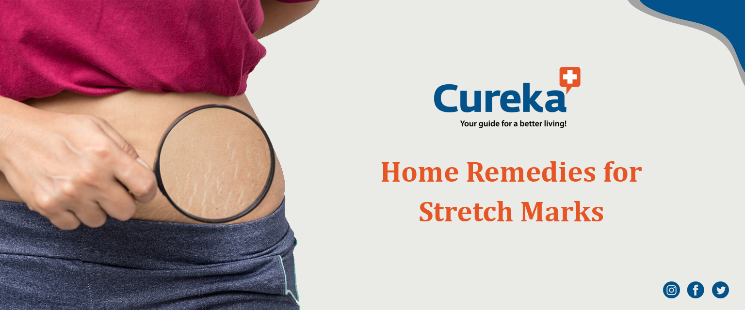 Home remedies for stretch marks
