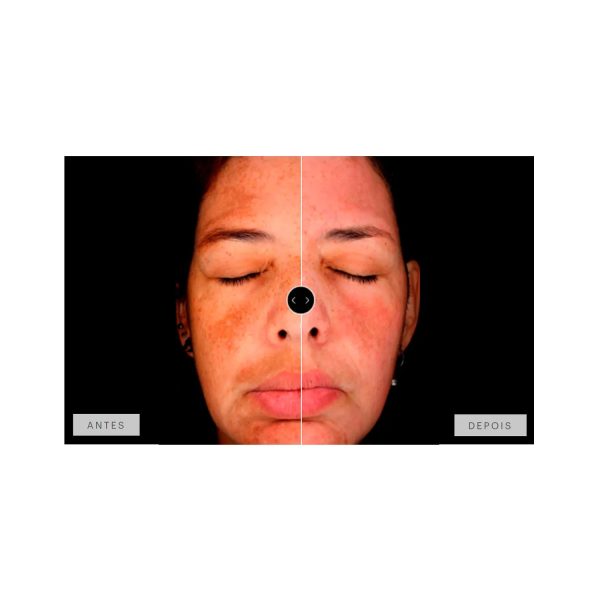 Mesoestetic Dermamelan