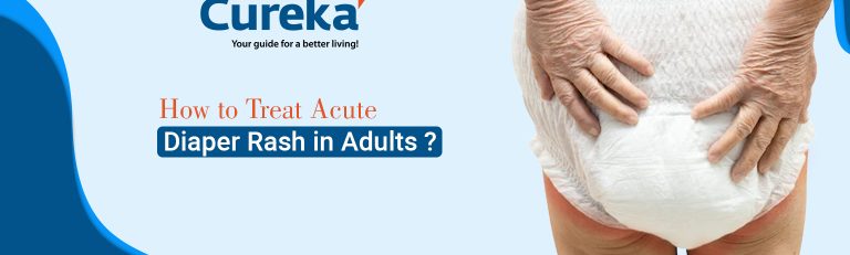How to Treat Acute Diaper Rash in Adults?
