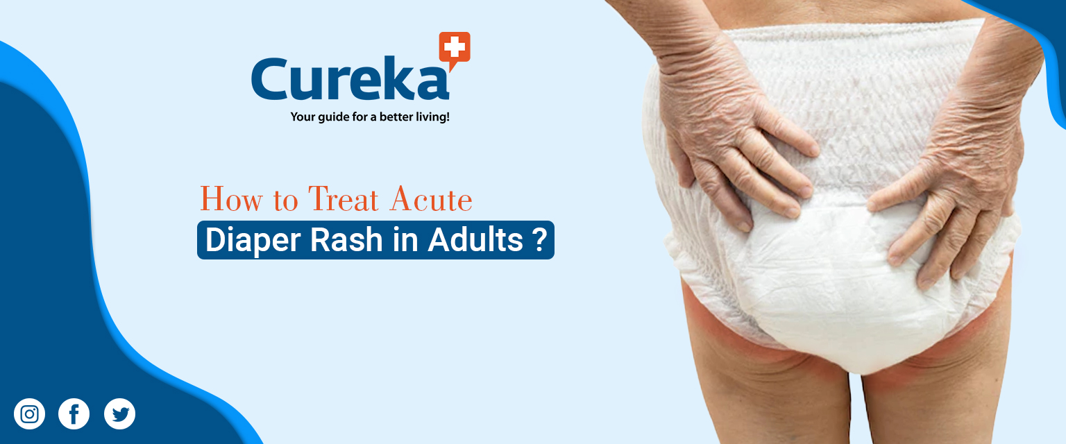 How to Treat Acute Diaper Rash in Adults?