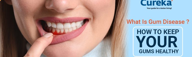 What Is Gum Disease? How to Keep Your Gums Healthy?