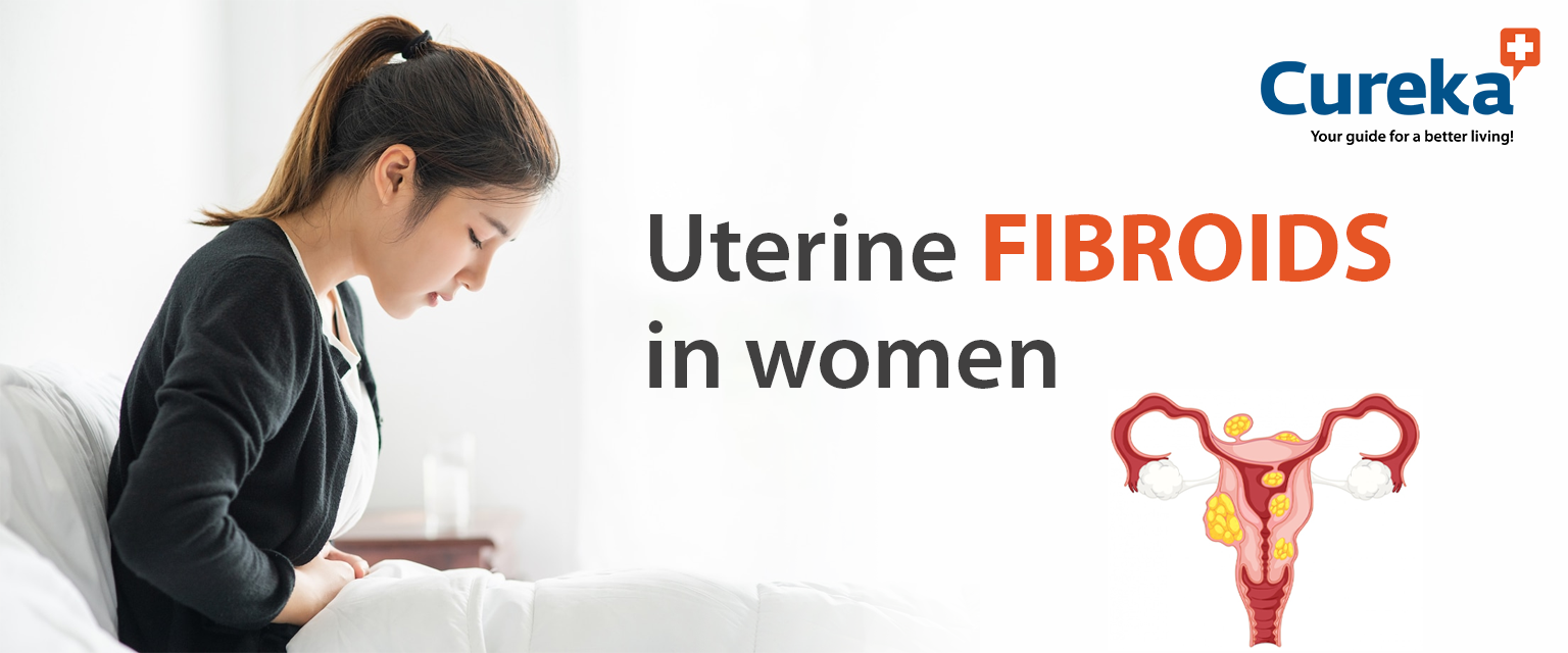 Uterine Fibroids in Women