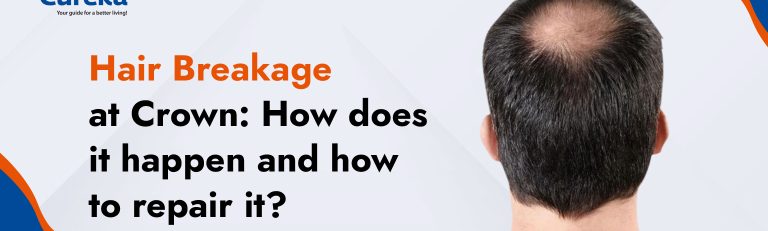 Hair Breakage at Crown: How Does it Happen and How to Repair it?