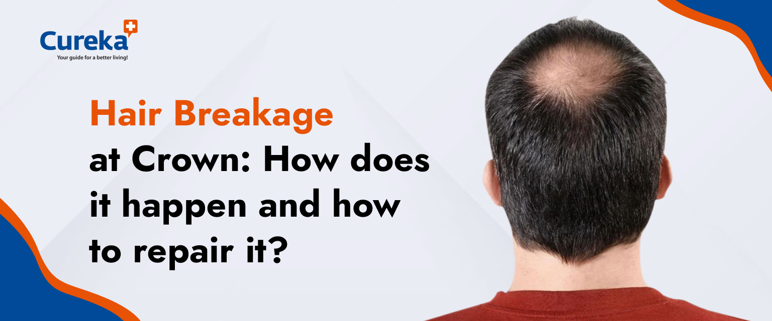 Hair Breakage at Crown: How Does it Happen and How to Repair it?