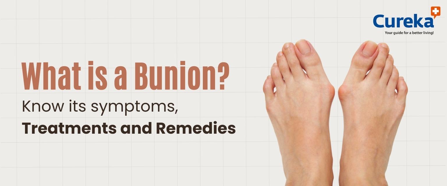 Bunion