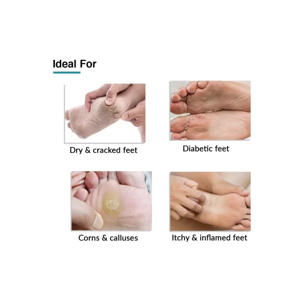 Fixderma Heel Repair Foobetik Foot Cream