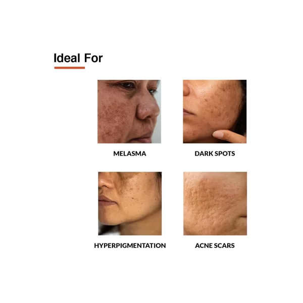best cream to remove dark spots on face