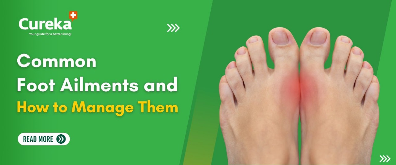 Common Foot Ailments and How to Manage Them