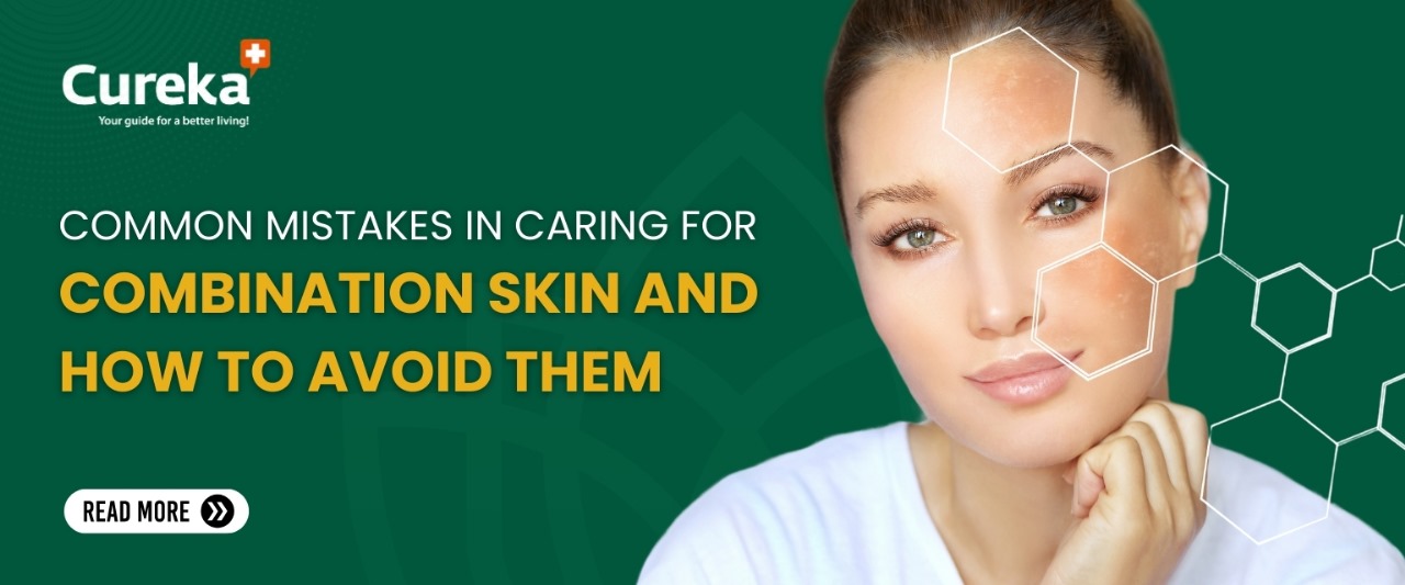 Common Mistakes in Caring for Combination Skin and How to Avoid Them