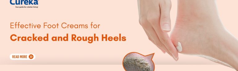 Effective Foot Creams for Cracked and Rough Heels
