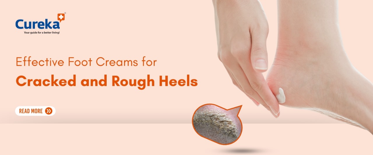Effective Foot Creams for Cracked and Rough Heels