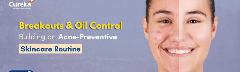 Breakouts & Oil Control: Building an Acne-Preventive Skincare Routine