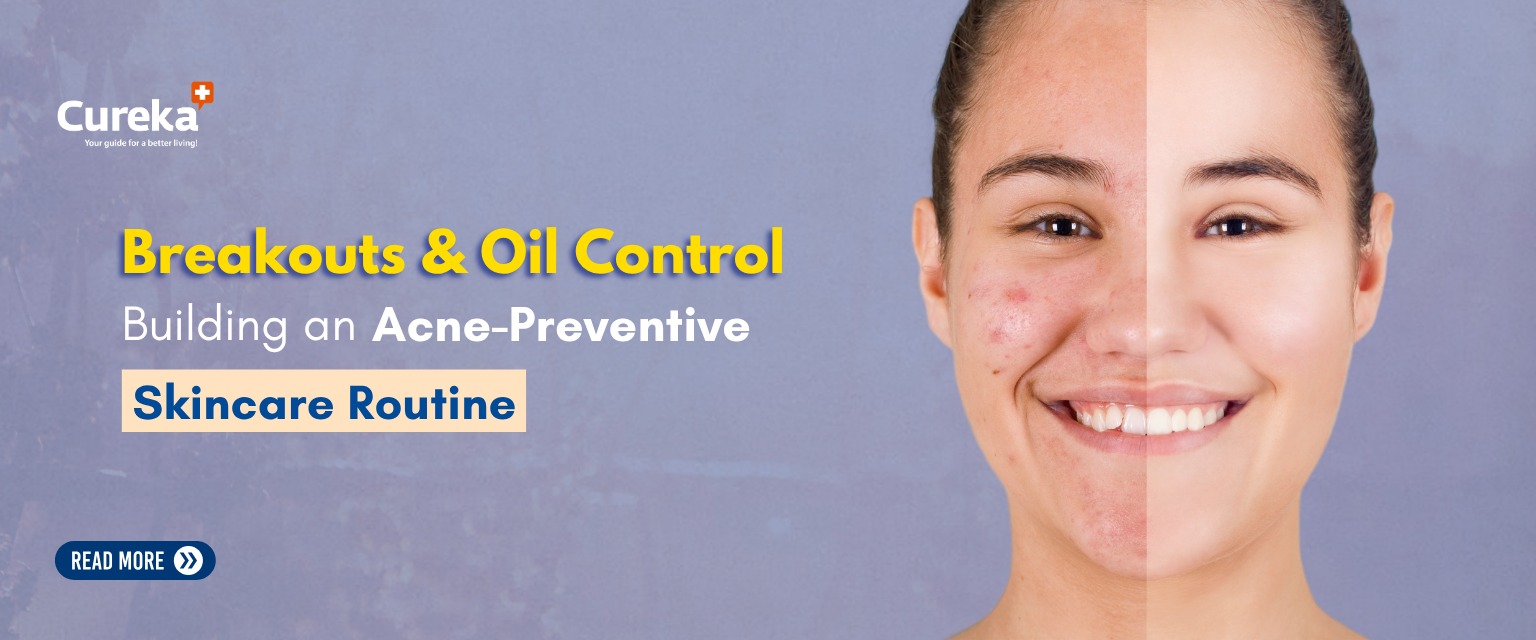 Breakouts & Oil Control: Building an Acne-Preventive Skincare Routine