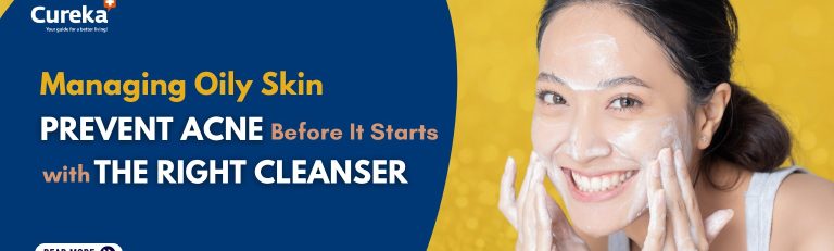 Managing Oily Skin: Prevent Acne Before It Starts With the Right Cleanser