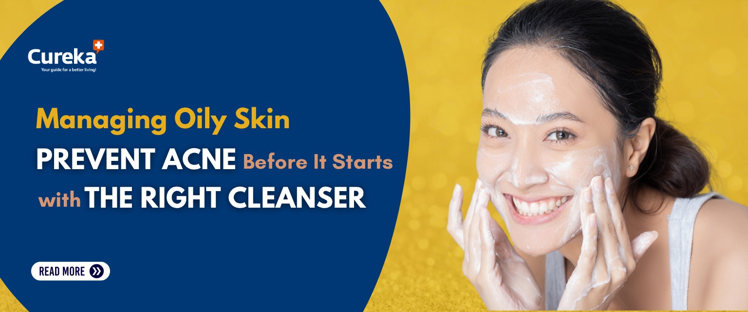 Managing Oily Skin: Prevent Acne Before It Starts With the Right Cleanser