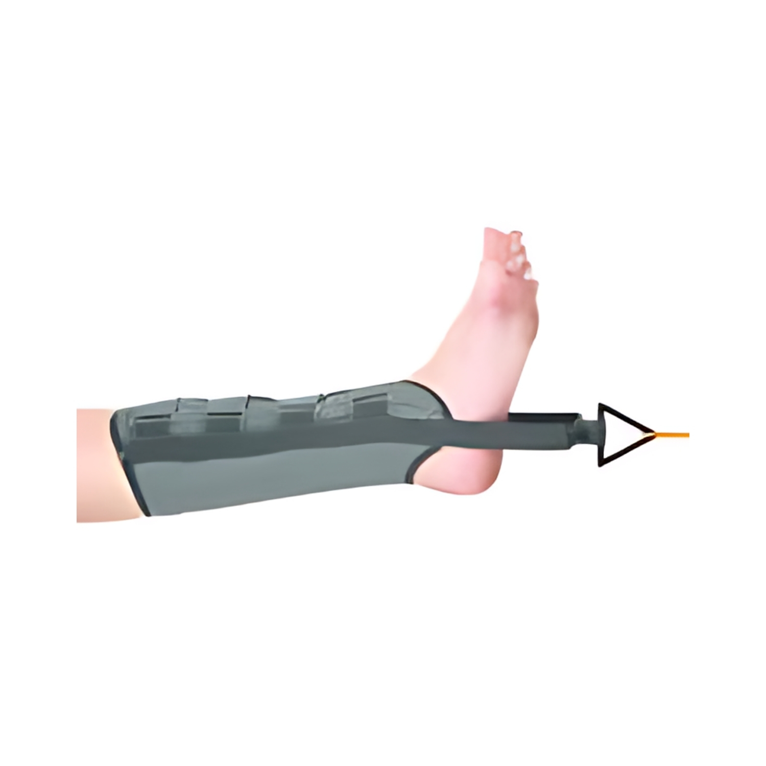 Accusure Leg tractoin (3)