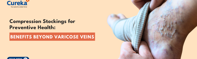 Compression Stockings for Preventive Health: Benefits Beyond Varicose Veins