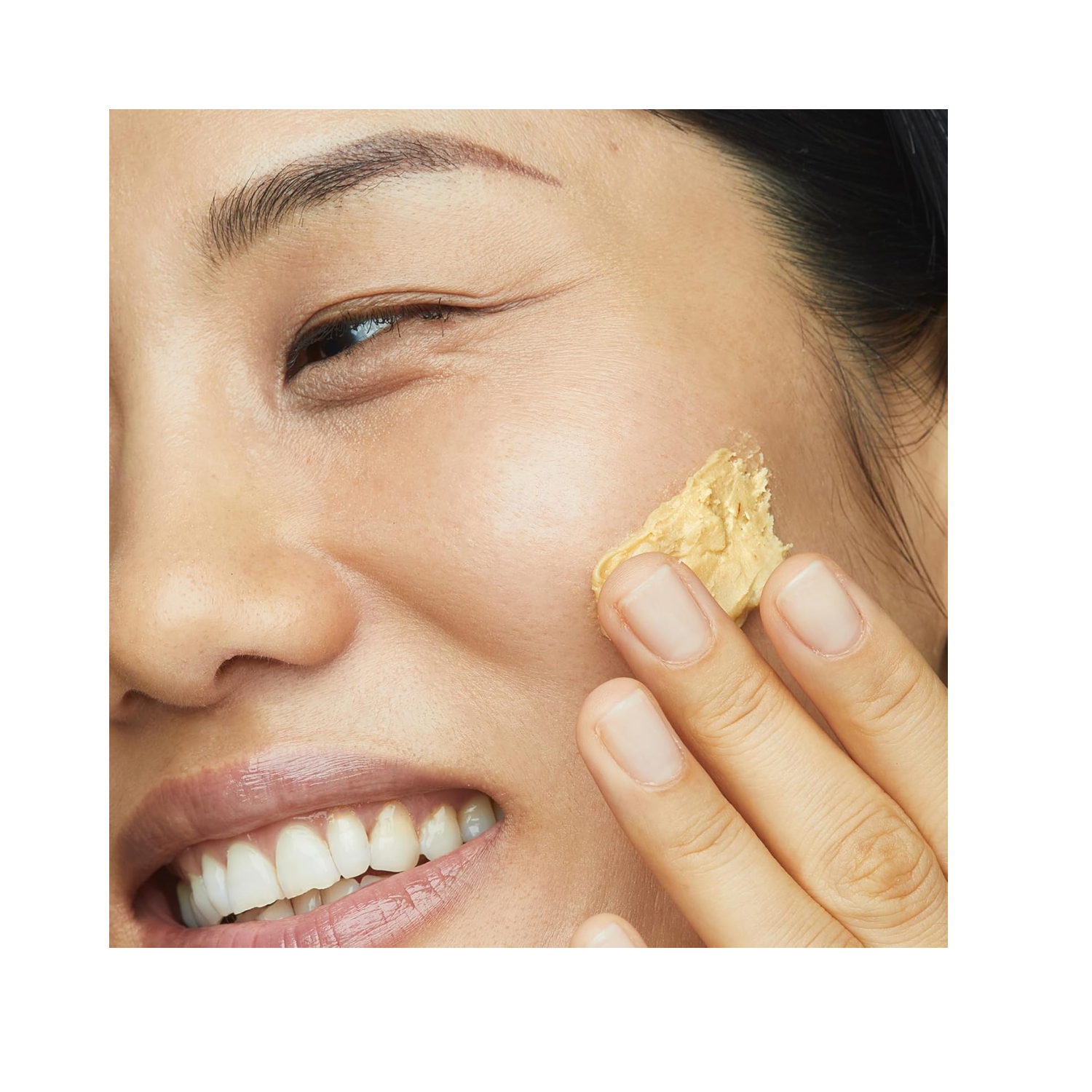 Microdermabrasion 3