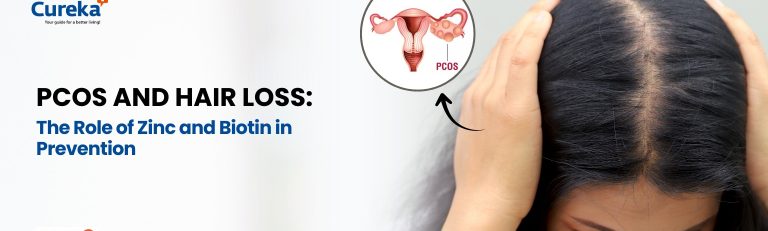 PCOS and Hair Loss: The Role of Zinc and Biotin in Prevention