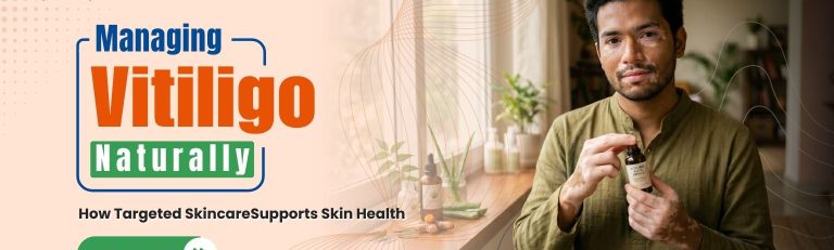 Managing Vitiligo Naturally: How Targeted Skincare Supports Skin Health
